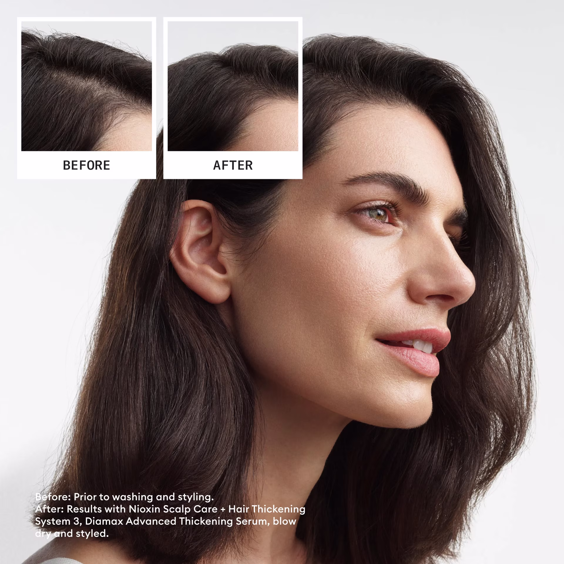 Nioxin System 3 Full Size Kit (300ml + 300ml + 100ml) - Image 2
