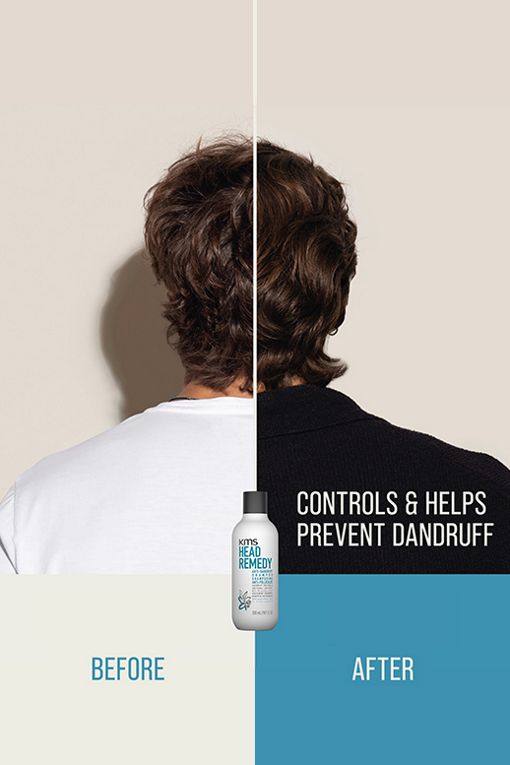 KMS California HeadRemedy Anti-dandruff Shampoo 300ml - Image 2