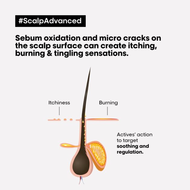 L'Oréal Professionnel Scalp Advanced Intense Soother Treatment for Sensitive, Itchy Scalps -200ml - Image 3